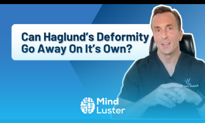 Can Haglund s Deformity Go Away On Its Own Back Of Heel Bump