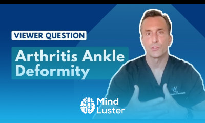 Rheumatoid Arthritis Ankle Deformity Ask Dr Moore