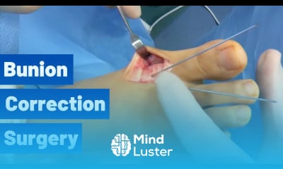 Bunion Correction Surgery Austin Bunionectomy Moore Foot Ankle Specialists