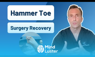 How Long Is Recovery From Hammer Toe Surgery