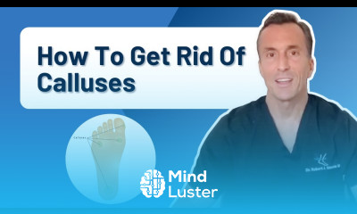 How Do You Get Rid Of Calluses Permanently