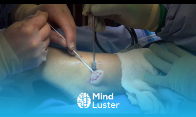 Ankle Ligament Repair Surgery Video Using an Internal Brace