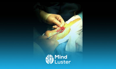 Achilles Tendon Rupture Repair Surgery Houston Foot Surgeon