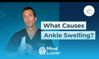 What Causes Ankle Swelling Ask Dr Moore Houston Foot and Ankle Surgeon