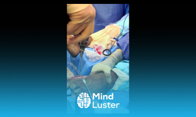 Bunion Surgery with TenFUSE Bone Fixation Dr Moore Houston Foot Surgeon