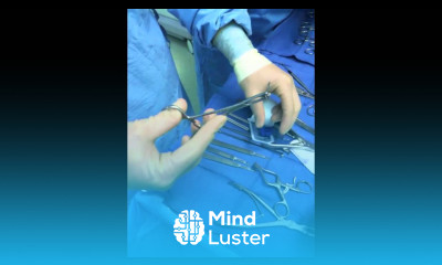 Toe Shortening Surgery with Smart Toe Implant Houston Foot Surgeon Dr Robert J Moore III