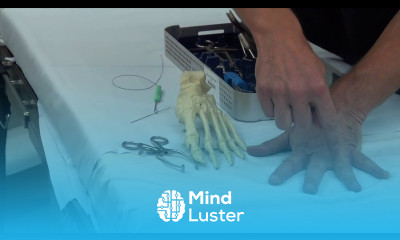 Toe Splay Correction Surgery Explained Using the Arthrex Plantar Plate Repair System