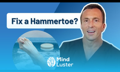 How Do You Fix a Hammertoe Ask Dr Moore