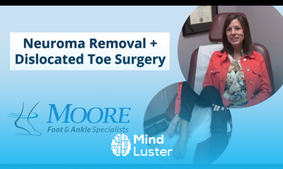 Neuroma Removal and Dislocated Toe Surgery Patient Testimonial Moore Foot Ankle