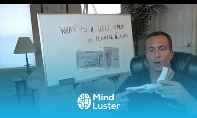 What is a Heel Spur or Plantar Fasciitis Dr Moore Explains