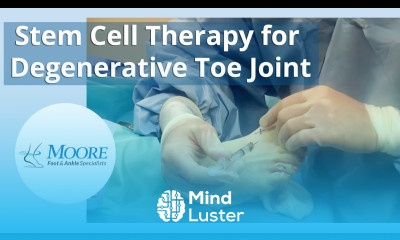 Stem Cell Therapy Demo for Degenerative Toe Joint Foot and Ankle Pain