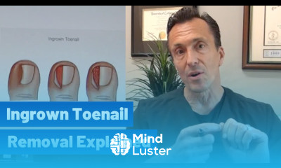 Ingrown Toenail Removal Dr Moore Explains the Permanent Cosmetic Procedure