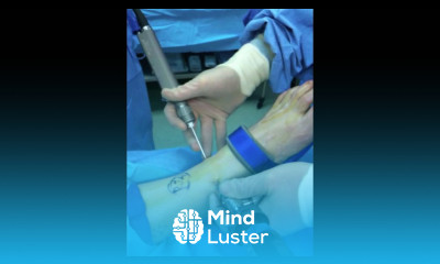 Ankle Arthroscopic Examination Surgery Video Removal of Damaged Cartilage