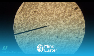 Is Candida Syndrome Real