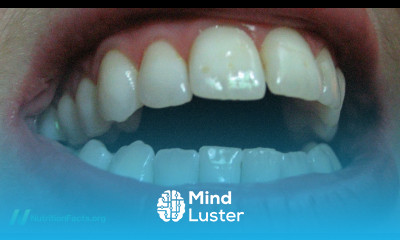 Oil Pulling for Teeth Whitening and Bad Breath Tested