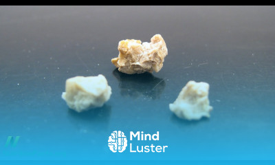 How to Treat Kidney Stones with Diet