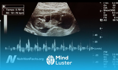 Heart Disease May Start in the Womb