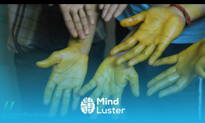 Topical Application of Turmeric Curcumin for Cancer