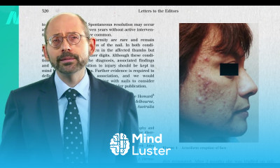 Do Vitamin B12 Supplements Cause Acne