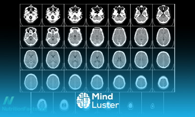 Preventing Brain Loss with B Vitamins