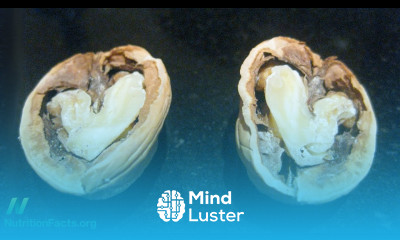 Walnuts and Artery Function