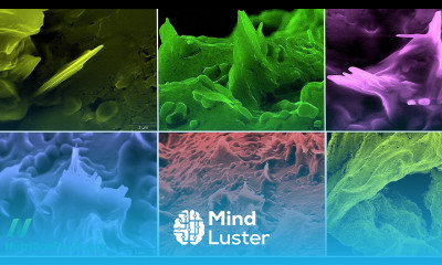 Cholesterol Crystals May Tear Through Our Artery Lining