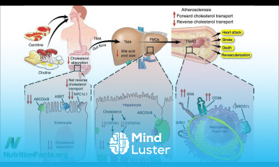 Carnitine Choline Cancer and Cholesterol The TMAO Connection