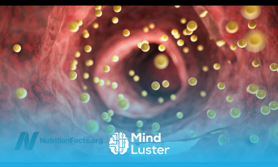 Can Cholesterol Get Too Low