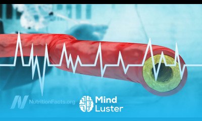 Cholesterol and Heart Disease Why Has There Been So Much Controversy
