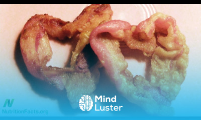 Low Carb Diets and Coronary Blood Flow