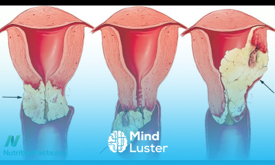 Why Might Vegetarians Have Less HPV