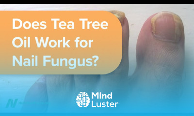Does Tea Tree Oil Work for Nail Fungus