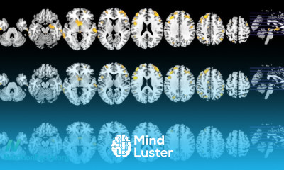 Preventing Parkinson s Disease With Diet