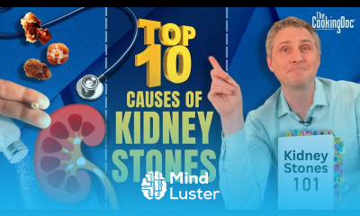 The Top 10 Causes of Kidney Stones The Cooking Doc