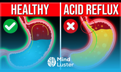 Stop ACID REFLUX In 5 Minutes By Drinking THIS