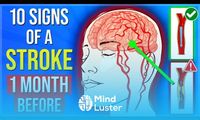 10 Signs Of A STROKE 1 Month Before It Happens You Must Never Ignore