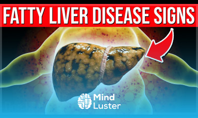 Fatty Liver Disease WARNING Signs You Must Know About