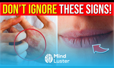 If You Have THIS You Are Nutrient Deficient Don t Ignore These 10 Signs