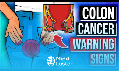 8 EARLY Warning Signs Of Colon Cancer You MUST NOT IGNORE ️