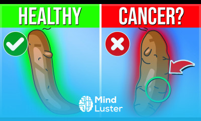 The Color Of Your STOOL Says THIS About Your Health Check Your 