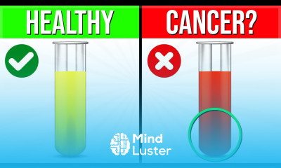 THIS Is What The Color Of Your PEE Is Warning You About Your Health