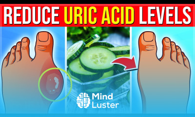 17 POWERFUL Super Foods That Reduce Your Uric Acid Levels