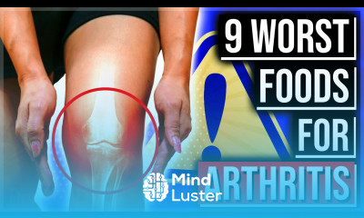 Your Arthritis HATES These 9 Foods You Keep Eating Find Out What They Are 