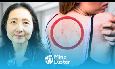 Inflammation Missing 10 Signs of High Cortisol