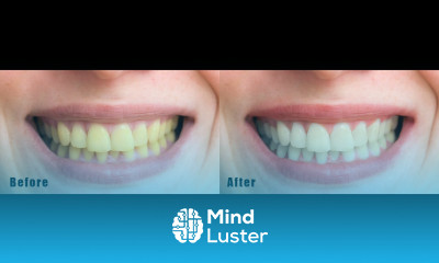 How to Whiten Teeth in Adobe Photoshop cc Simple Trick