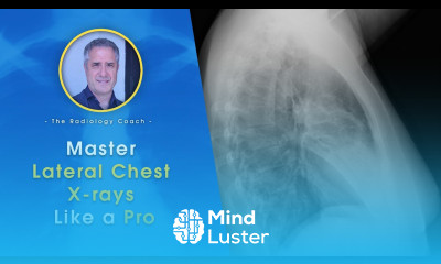 Master Lateral CHEST X RAYS like a PRO