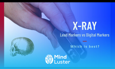 X ray LEAD MARKERS vs DIGITAL MARKERS Which is best