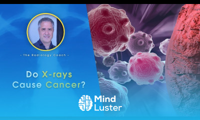 Do X rays CAUSE CANCER