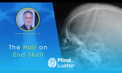 The HAIR ON END SKULL Radiograph