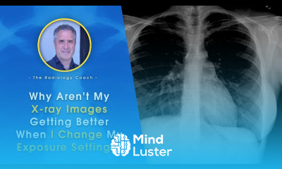 Why Aren t My X ray IMAGES GETTING BETTER When I Change My EXPOSURE SETTINGS